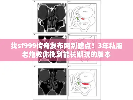 找sf999传奇发布网别瞎点!3年私服老炮教你挑到能长期玩的版本 找sf999传奇发布网别瞎点!3年私服老炮教你挑到能长期玩的版本