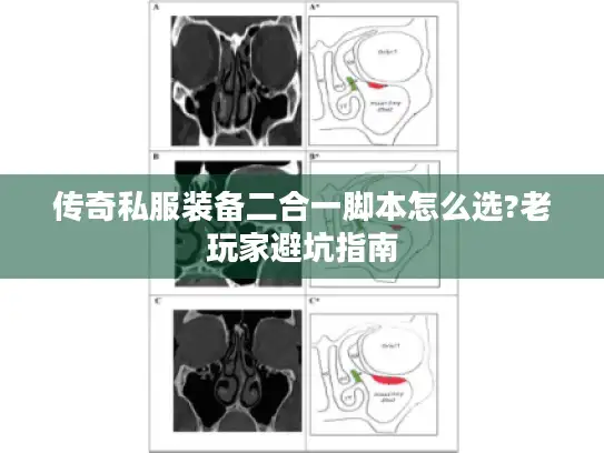 传奇私服装备二合一脚本怎么选?老玩家避坑指南
